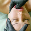 TMJ TMD Treatment